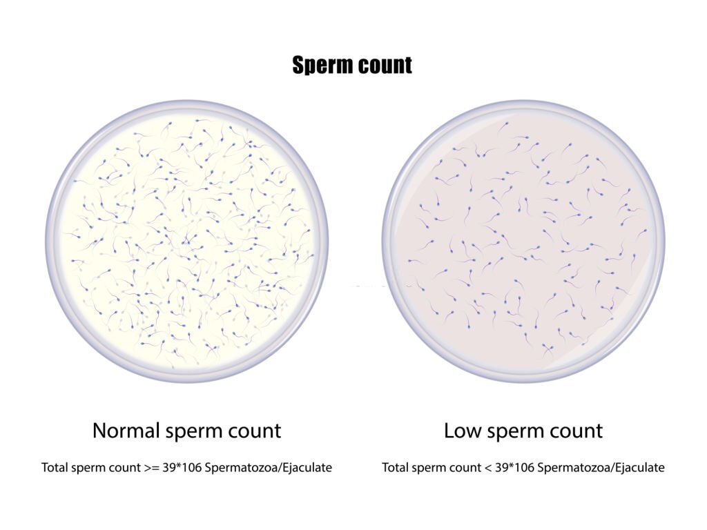 Sperm Morphology Size And Shape Does It Affect Fertility