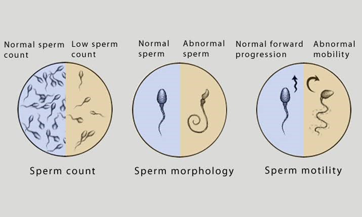 Male Infertility Doctors in India