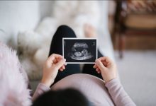 baby gender ultrasound near me